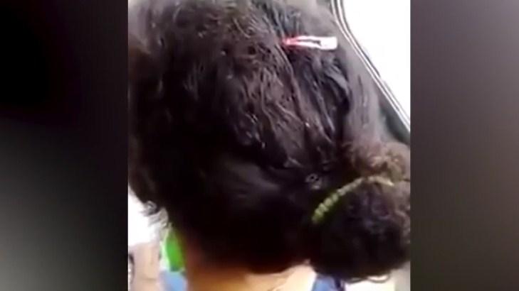 Ženi u autobusu je odjednom počelo nešto da gmiže po kosi: Zgrozićete se kada vidite koliko toga ima