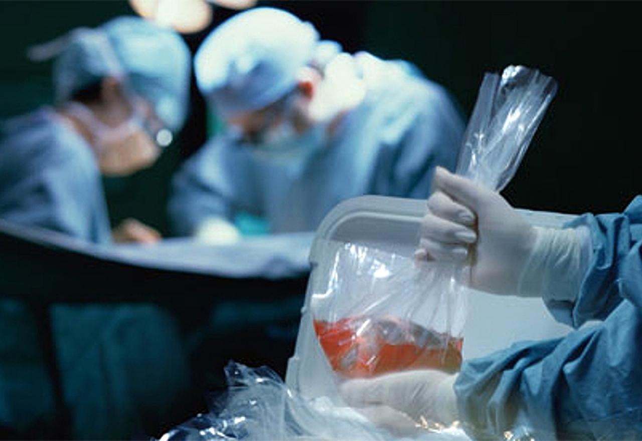Mnogi se upućuju na transplantacije u inozemstvo - Avaz