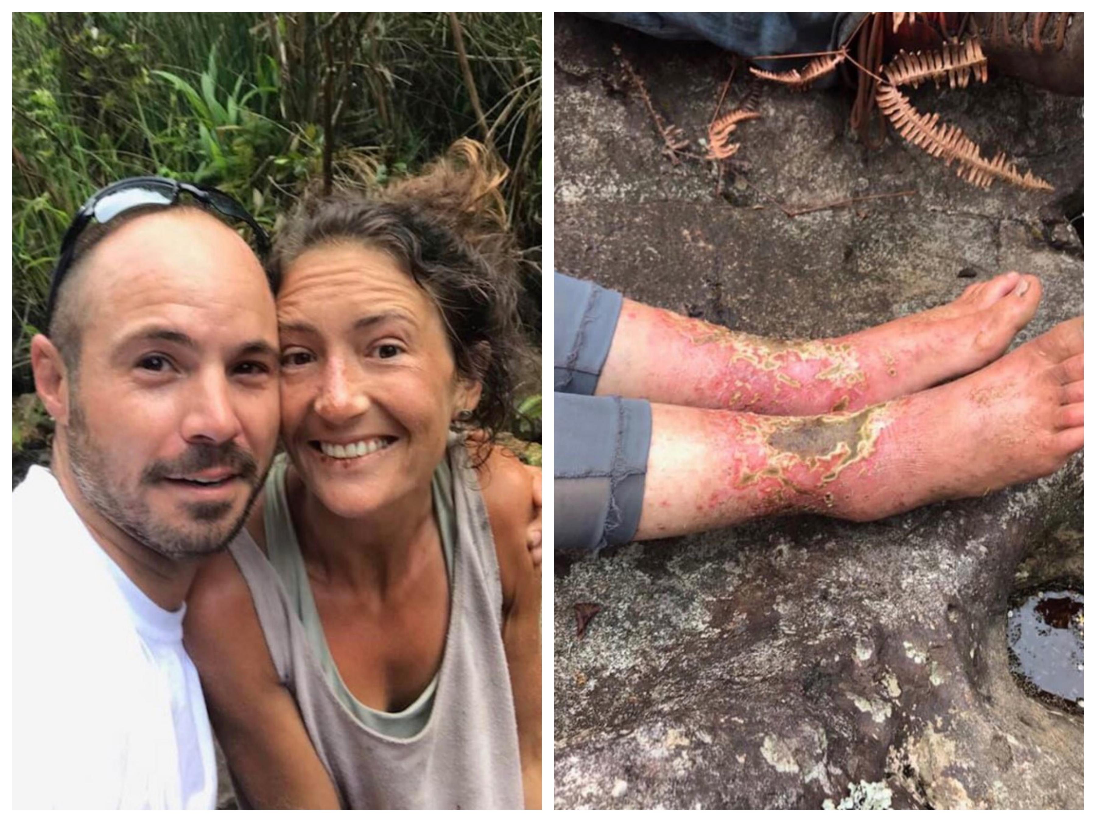 Instruktorica joge nestala u gustim šumama: Pronašli je živu nakon 17 dana