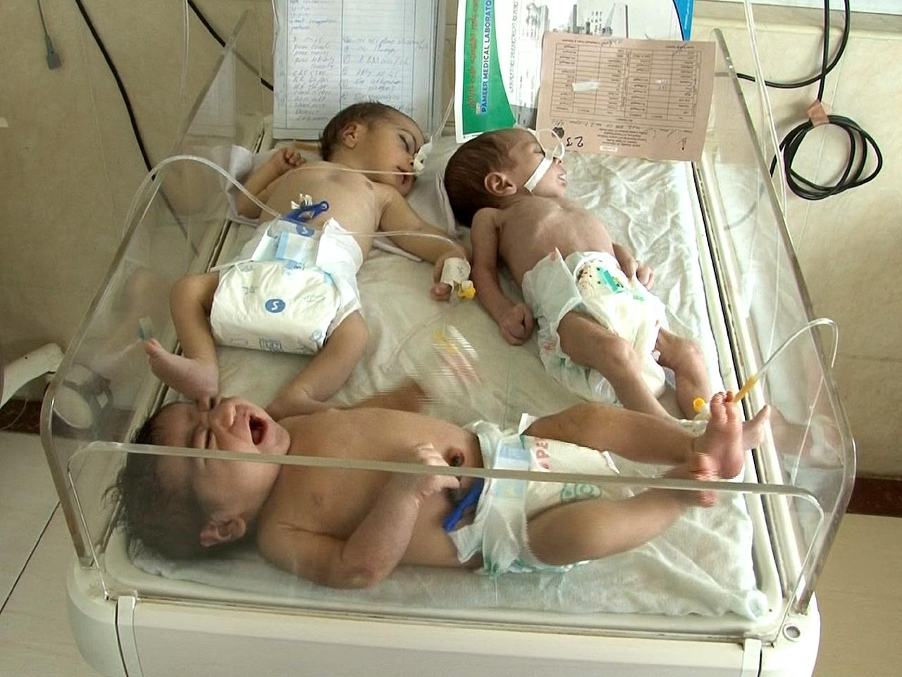 Afganistanske bolnice pune djece s upalom pluća