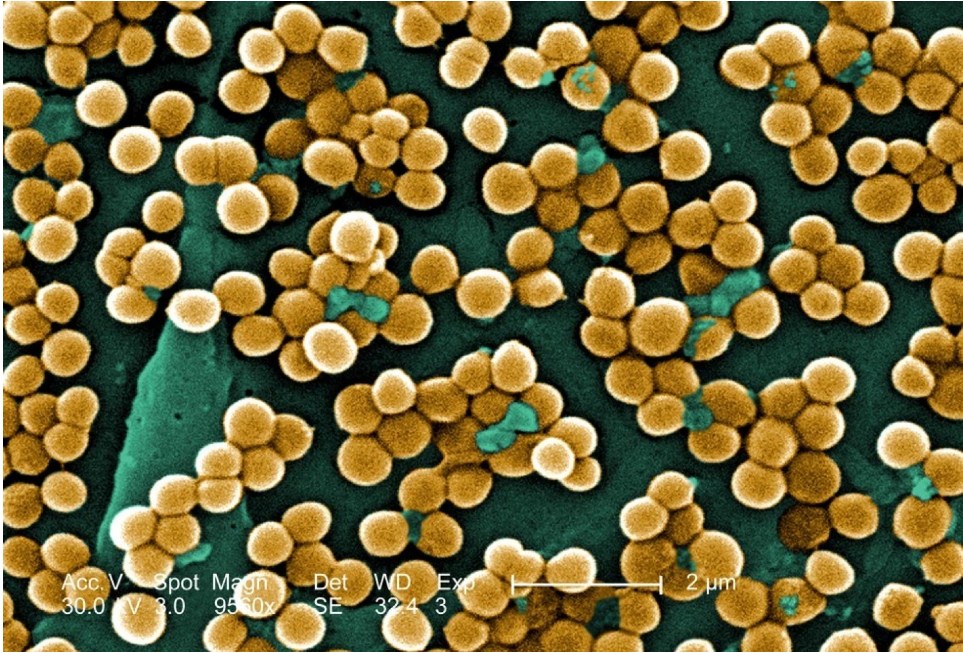 bakterije-nos-1