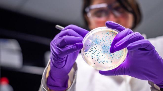 Rezultati istraživanja ukazuju kako su bolnice ključna mjesta zaraze ovom bakterijom - Avaz