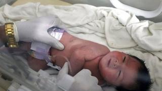 Bračni par nije jedini koji želi usvojiti bebu iz Sirije: Javili nam se doktori iz Novog Sada