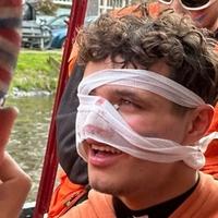 Lando Noris doživio povredu lica na zabavi u Amsterdamu