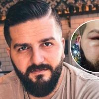 Novinar Mirza Dervišević nakon napada za "Avaz": Prijetio je da će me ubiti, ali ja ću nastaviti časno i pošteno obavljati svoj posao